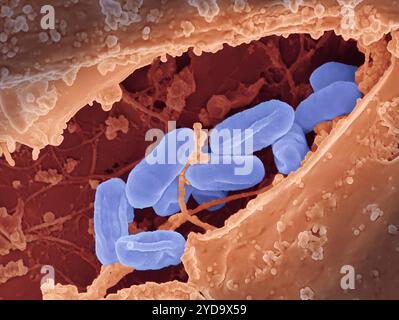 Micrografia elettronica a scansione dei batteri Rickettsia typhi. Batteri Rickettsia typhi 016867 469 Foto Stock