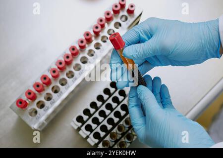 Mani con guanti che trattengono la fiala del campione di sangue durante l'esecuzione delle analisi in ambiente di laboratorio scientifico. Rack di provette visibili sullo sfondo Foto Stock