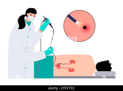 Illustrazione concettuale di una procedura ureteroscopica. Si tratta di una procedura eseguita per esaminare o trattare problemi nel tratto urinario, come i calcoli renali. Foto Stock