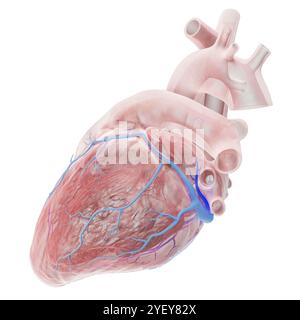 Illustrazione di vene coronarie con la vena di Marshall (blu scuro) evidenziata. La grande vena cardiaca si vede scorrere attraverso il ventricolo sinistro (camera inferiore) del cuore. La vena di Marshall, nota anche come vena obliqua atriale sinistra, è un residuo embrionale della vena cava superiore. Si ritiene che sia una fonte di trigger di fibrillazione atriale (AF), una frequenza cardiaca irregolare e spesso anormalmente veloce. Per una versione etichettata di questa immagine, vedere F043/3535. Foto Stock