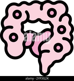 Questa illustrazione mostra un colon rosa con polipi, che sono escrescenze anomale del tessuto Illustrazione Vettoriale