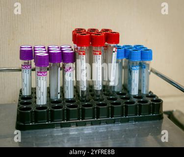 Bangkok, Thailandia. 3 novembre 2024. Un primo piano di una raccolta di provette di sangue, per il check-in del sangue, al Samitivej Sukhumvit, un ospedale privato di Bangkok. worldís Thailandia è una delle destinazioni più popolari per il turismo medico, offre trattamenti più convenienti rispetto a quelli in alcuni paesi occidentali e attira oltre 3 milioni di pazienti stranieri ogni anno. I turisti medici spendono per una serie di servizi, dai controlli sanitari di routine e interventi chirurgici elettivi a trattamenti complessi, generando miliardi di entrate. Credito: SOPA Images Limited/Alamy Live News Foto Stock