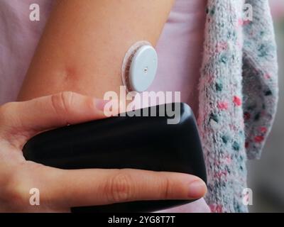 Attivazione e lettura del sensore per il monitoraggio continuo del glucosio – CGM. Diabete di tipo 1. L'insulina dipende. Foto Stock