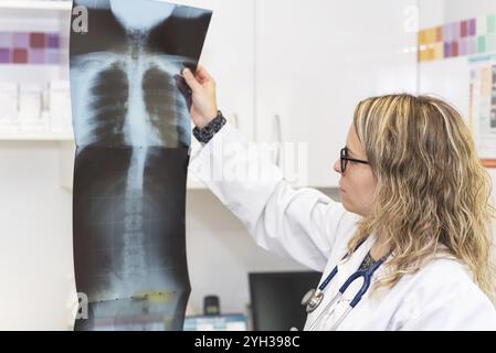 Medico donna esaminando la radiografia in ospedale Foto Stock