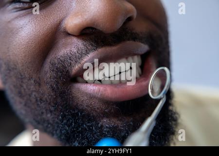 Dentista maschio che ispeziona i denti del paziente con lo specchio fornendo un trattamento essenziale durante il check-up Foto Stock