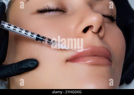 Un estetista esegue una procedura di aumento delle labbra con acido ialuronico. Il processo di iniezione del riempitivo nelle labbra. Foto Stock