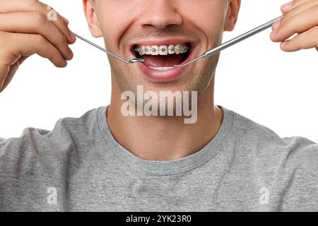 Esame dei denti dell'uomo con le bretelle usando strumenti dentali su sfondo bianco, primo piano Foto Stock