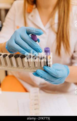 Tecnici di laboratorio che gestiscono campioni di sangue con precisione e cura per l'analisi medica in un laboratorio clinico Foto Stock