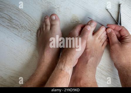 Uomo caucasico impegnato a riporre la sua unghia destra a punta grande dopo aver tagliato le unghie con un tagliaunghie. Foto Stock