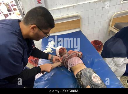 I palestinesi feriti, compresi i bambini, vengono portati all'ospedale di al-Ahly per cure mediche i palestinesi feriti, compresi i bambini, vengono portati all'ospedale di al-Ahly per cure mediche dopo gli attacchi israeliani a Gaza City, il 18 novembre 2024. Foto di Hadi Daoud apaimages Gaza City Striscia di Gaza territorio palestinese 181124 Gaza HD 007 Copyright: XapaimagesxHadixDaoudxxapaimagesx Foto Stock