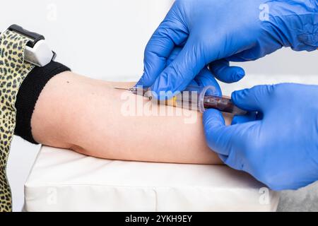 Primo piano di un operatore sanitario che indossa guanti che aspirano sangue dal braccio di un paziente Foto Stock