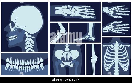 Set di immagini a raggi X. Raggi X con ossa, cranio, bacino, braccia e gambe. Artrite e osteoartrite. Diagnosi e trattamento. Sanità e medicina Illustrazione Vettoriale