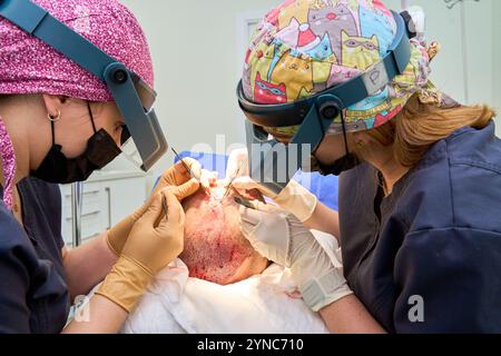 Due chirurghi che eseguono una procedura dettagliata di trapianto di capelli con strumenti di precisione Foto Stock