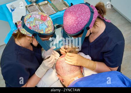 Vista dall'alto di due chirurghi che eseguono interventi chirurgici di trapianto di capelli con lenti di ingrandimento Foto Stock