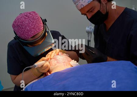 Due chirurghi che eseguono una procedura dettagliata di trapianto di capelli con strumenti chirurgici Foto Stock