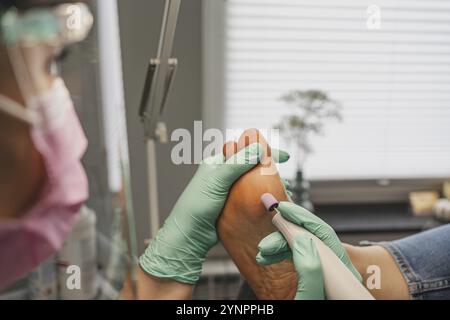 Trattamento podiatrico del piede, fresatura dell'epidermide con uno strumento. Un primo piano del trattamento. Primo piano sulla fresatrice e sui palmi con guanti Foto Stock