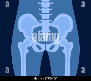 Raggi X di articolazione dell'anca pelvi ossa umane anatomia ortopedica diagnostica medica. Radiografia roentgen radiologia shot chirurgia femorale scheletro sano della colonna vertebrale anatomi Illustrazione Vettoriale