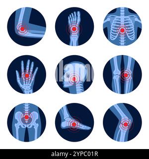 Parti del corpo umano in vista raggi X. Diversi raggi X di parti del corpo umano con punti dolenti scheletrici. Lesione anatomica cronica del corpo a forma di cerchio. V Illustrazione Vettoriale