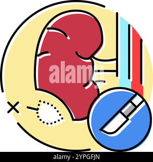 illustrazione vettoriale icona colore ospedale chirurgia nefrectomia Illustrazione Vettoriale