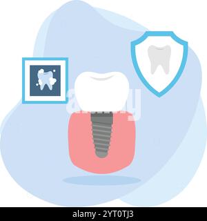 Impianto dentale o radice dentale artificiale protesica, sostituire il design dell'icona del colore vettoriale dei denti in titanio singolo, simbolo odontoiatrico, Healthca Illustrazione Vettoriale