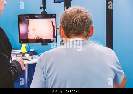 Un uomo guarda nel binocolo di un microscopio dentale. Davanti a lui c'è un monitor con un'immagine di una mascella e un dente Foto Stock