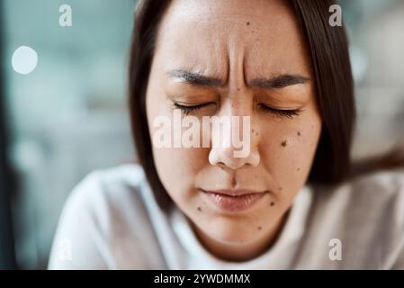 Mal di testa, stress e volto della donna d'affari in ufficio con sintomi di malattia, malattia o allergia. Emicrania, primo piano e donna asiatica con Foto Stock