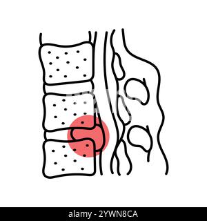 Icona della linea colorata del disco ernia intervertebrale. Malattie della colonna vertebrale. Vertebrologia. Elemento isolato vettoriale. Traccia modificabile. Illustrazione Vettoriale