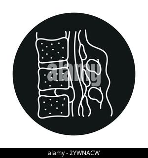 Icona della linea colorata del disco ernia intervertebrale. Malattie della colonna vertebrale. Vertebrologia. Elemento isolato vettoriale. Traccia modificabile. Illustrazione Vettoriale