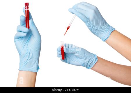 Set di mani in guanti per uso medico che contengono una provetta per analisi e una pipetta con sangue su fondo vuoto. Analisi di laboratorio, test medici, assistenza sanitaria d Foto Stock