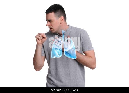 Uomo con asma che tossisce su sfondo bianco. Illustrazione dei polmoni Foto Stock
