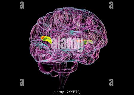 Illustrazione computerizzata di un cervello umano con il giroscopio temporale trasversale evidenziato, anteriore in verde e posteriore in arancione. Queste regioni sono coinvolte nell'elaborazione uditiva e nella comprensione del linguaggio. Foto Stock