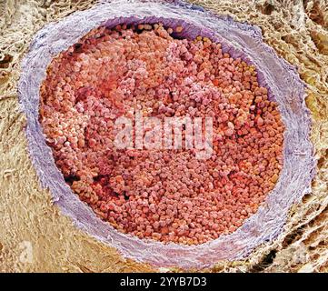 Arteria. Micrografia elettronica a scansione colorata (SEM) di una sezione trasversale attraverso un'arteria muscolare. L'arteria è piena di globuli rossi (eritrociti, rossi) che trasportano ossigeno intorno al corpo. Le pareti dell'arteria sono costituite dalla tunica intima e dalla tunica media muscolare più interna e dalla tunica adventitia fibrosa. Le arterie muscolari si trovano nei rami arteriosi più piccoli. Il muscolo che contengono consente di controllare il volume di sangue che raggiunge il tessuto che forniscono. Ingrandimento: X300 se stampato a 10 centimetri di larghezza. Foto Stock