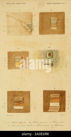 Dictionnaire universel d'histoire naturelle, Parigi, Chez les editeurs M. Renard, Martinet et et cie, rue et Hotel Mignon, 2 (quartier de l'École-de-Médecine), 1847-1849, storia naturale, umano, dizionari, questa illustrazione presenta una serie di studi anatomici incentrati sulla colonna vertebrale umana e sulle strutture correlate. Ogni sezione numerata evidenzia diversi aspetti dell'anatomia della colonna vertebrale. 1) la prima sezione mostra una colonna vertebrale con i muscoli e i legamenti circostanti, sottolineandone i punti di attacco. 2) la seconda sezione si articola sui dischi intervertebrali, con i dettagli Foto Stock