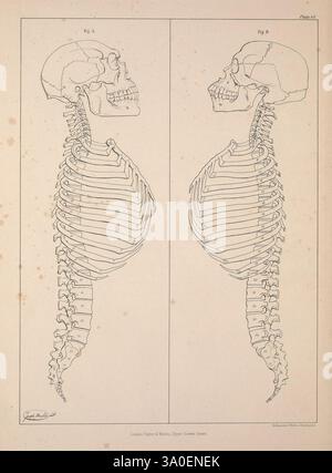 Comparative, osteology, London, Taylor and Walton, 1847, Bones, l'illustrazione presenta due rappresentazioni anatomiche dettagliate di uno scheletro umano visto lateralmente. Ogni figura mostra i componenti distinti della struttura scheletrica, tra cui il cranio, la gabbia toracica e la colonna vertebrale. Gli scheletri sono etichettati con sezioni numerate, evidenziando le singole ossa e le caratteristiche anatomiche. Questa rappresentazione educativa enfatizza la complessità dell'anatomia umana, fornendo informazioni sull'allineamento e la struttura del sistema scheletrico. L'opera d'arte è presentata in un ambiente pulito e tecnico Foto Stock