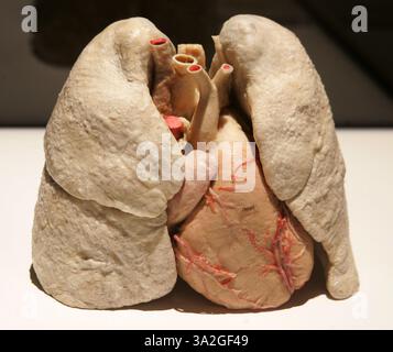 19 novembre 2005; New York, NY, Stati Uniti; una vista di polmoni e cuore sani alla mostra "Bodies...The Exhibition", che è una nuova mostra con 22 veri esemplari di corpo umano intero e più di 260 organi e parti del corpo parziali in mostra al South Street Seaport. Gli esemplari del corpo umano sono conservati attraverso una tecnica rivoluzionaria chiamata conservazione dei polimeri. Durante questo processo il tessuto umano viene conservato in modo permanente utilizzando gomma siliconica liquida che viene trattata e indurita. Dopo il processo che può richiedere più di un anno per prepararsi, il corpo diventa gommato e resistente alla decomposizione. Tutte le Foto Stock