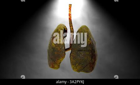 Fumatore polmoni umani. Rendering 3d generato dal computer Foto Stock