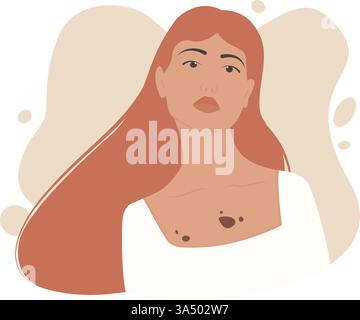 Illustrazione del cancro della pelle e del melanoma della donna. Il mese della sensibilizzazione sul cancro, lo screening delle donne. Salute personale Illustrazione Vettoriale