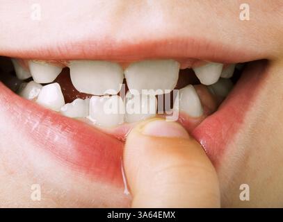 Il bambino mostra i denti. Primo piano in studio Foto Stock