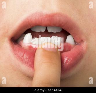 Il bambino mostra i denti. Primo piano in studio Foto Stock