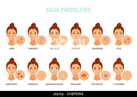 Vari problemi della pelle. Dermatologia e cosmetologia. Illustrazione vettoriale Illustrazione Vettoriale