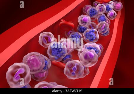 Linfoma diffuso a grandi cellule B (DLBCL) - Vista ravvicinata illustrazione 3d. Foto Stock