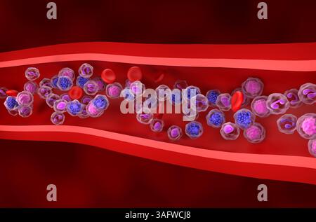 Linfoma diffuso a grandi cellule B (DLBCL) - Vista isometrica illustrazione 3d. Foto Stock
