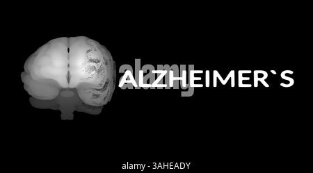 Visualizzazione della scansione cerebrale con regioni contrastanti, adiacenti al testo di "ALZHEIMER", che illustra la degenerazione neurale associata alla malattia. Foto Stock