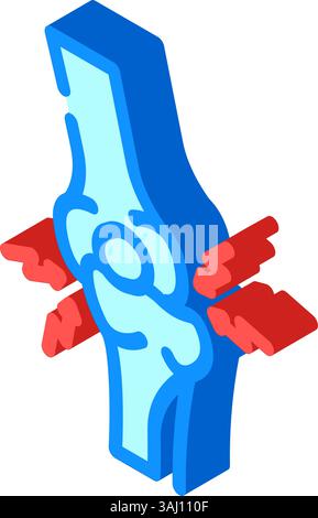illustrazione del vettore isometrico a icone di lesione da frattura da lussazione articolare Illustrazione Vettoriale