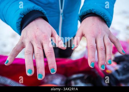 Marzo 11, 2015 - Tanana, Alaska, Stati Uniti - Iditarod musher Zoya DeNure le mani a Tanana checkpoint durante il sentiero Iditarod Sled Dog Race mercoledì, 11 marzo 2015. DeNure graffiato poco dopo questa foto è stata scattata. (Credito Immagine: © Loren Holmes/Alaska spedizione News via ZUMA filo) Foto Stock