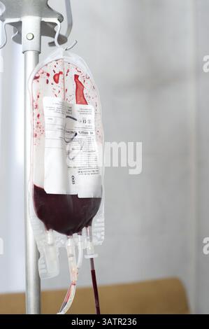 La confezione trasparente appesa al rack viene riempita con sangue del donatore Foto Stock