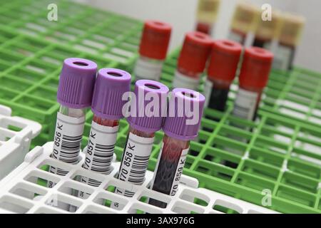 Donazione di sangue Foto Stock