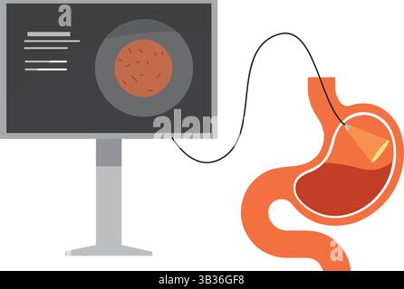 Icona del logo dell'endoscopia. Stomaco gastroscopia cartoon gastrite medicina segno cancro icona sistema egd Illustrazione Vettoriale