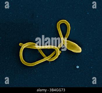 24 novembre 2014 - Atlanta, Stati Uniti d'America - Vista microscopica della particella del virus Ebola. Micrografia elettronica a scansione colorata di particelle filamentose del virus Ebola. (Immagine di credito: © NIAID via ZUMA Wire) Foto Stock
