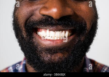Primo piano ritratto dei denti di un uomo nero adulto sorridente. Foto Stock